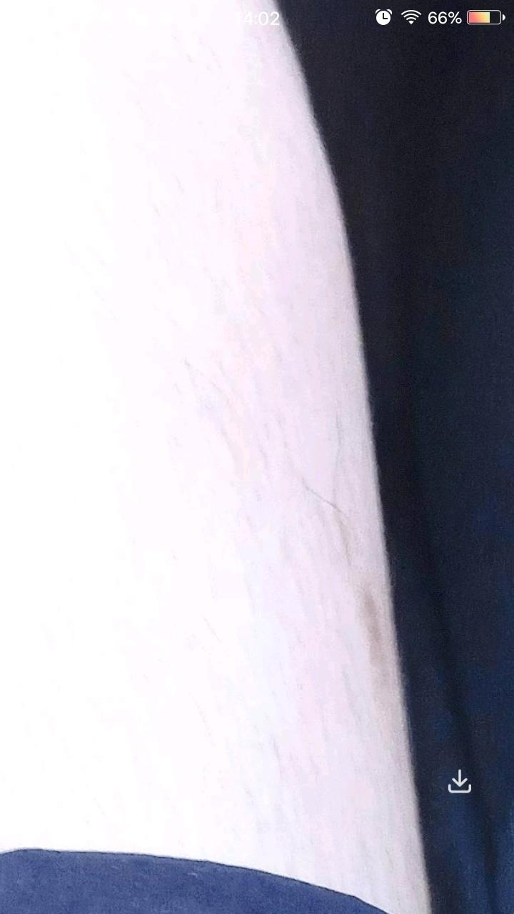 [图片]