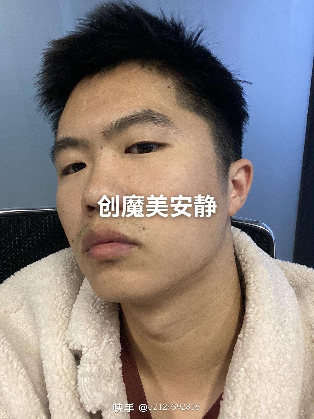 [图片]