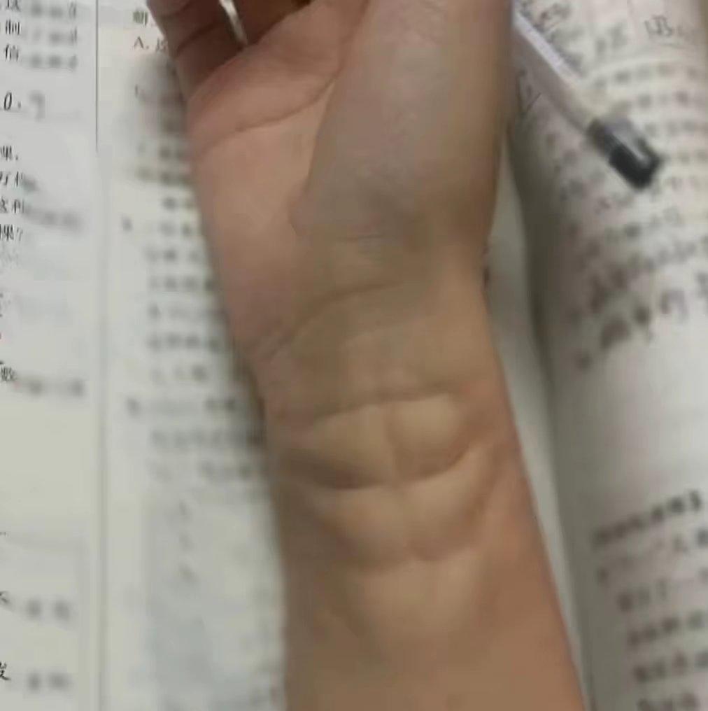 [图片]