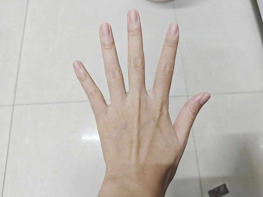 [图片]